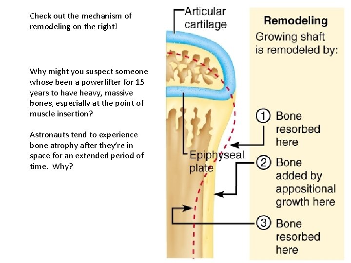 Check out the mechanism of remodeling on the right! Why might you suspect someone