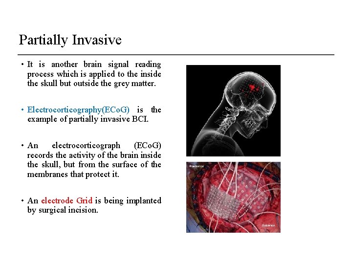 Partially Invasive • It is another brain signal reading process which is applied to