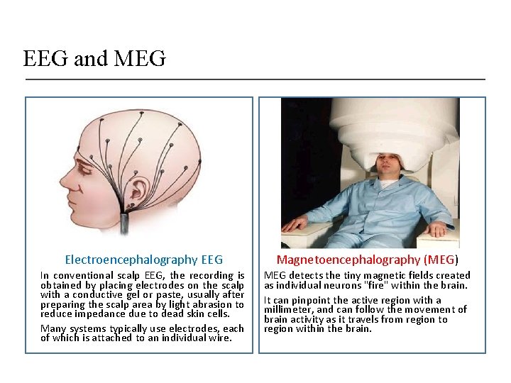 EEG and MEG Electroencephalography EEG Magnetoencephalography (MEG) In conventional scalp EEG, the recording is