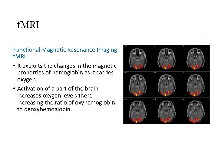 f. MRI Functional Magnetic Resonance Imaging f. MRI • It exploits the changes in