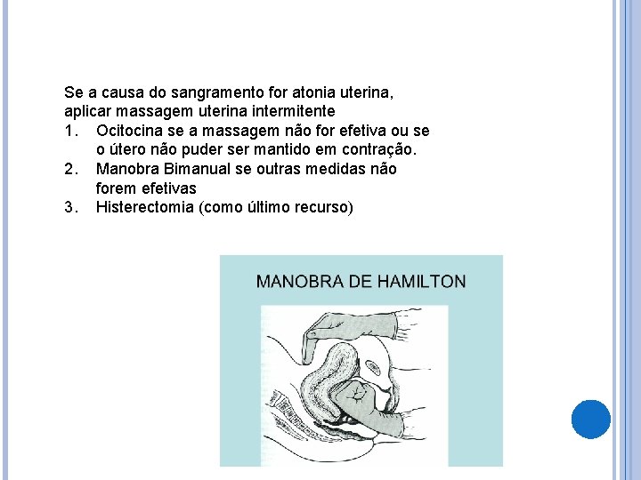 Se a causa do sangramento for atonia uterina, aplicar massagem uterina intermitente 1. Ocitocina
