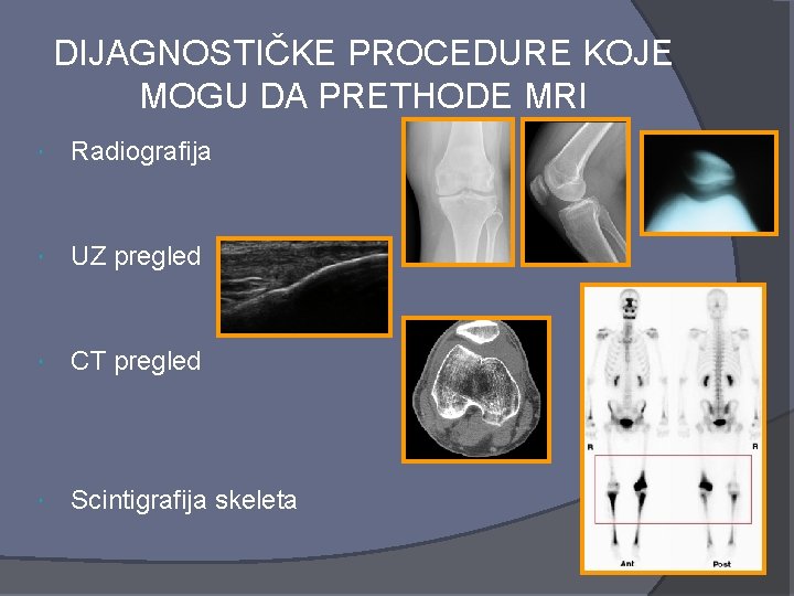 DIJAGNOSTIČKE PROCEDURE KOJE MOGU DA PRETHODE MRI Radiografija UZ pregled CT pregled Scintigrafija skeleta