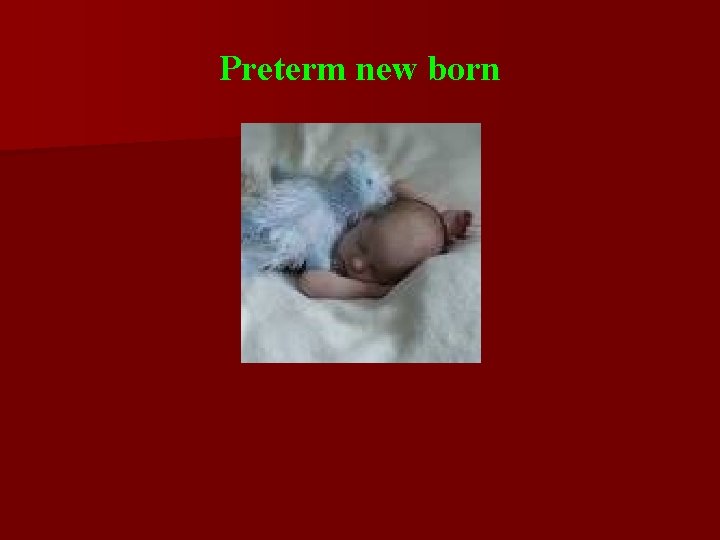 Preterm new born 