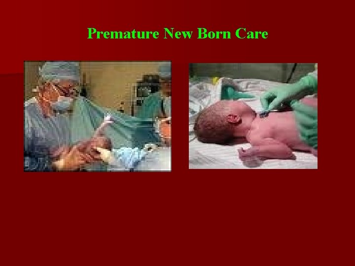 Premature New Born Care 