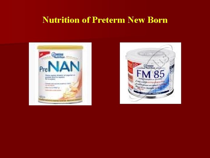 Nutrition of Preterm New Born 