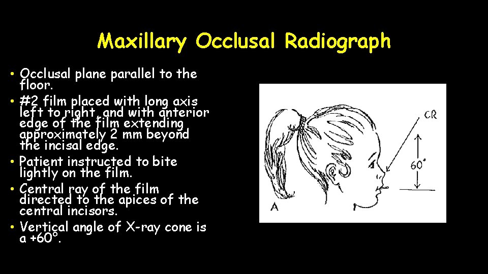 Maxillary Occlusal Radiograph • Occlusal plane parallel to the floor. • #2 film placed