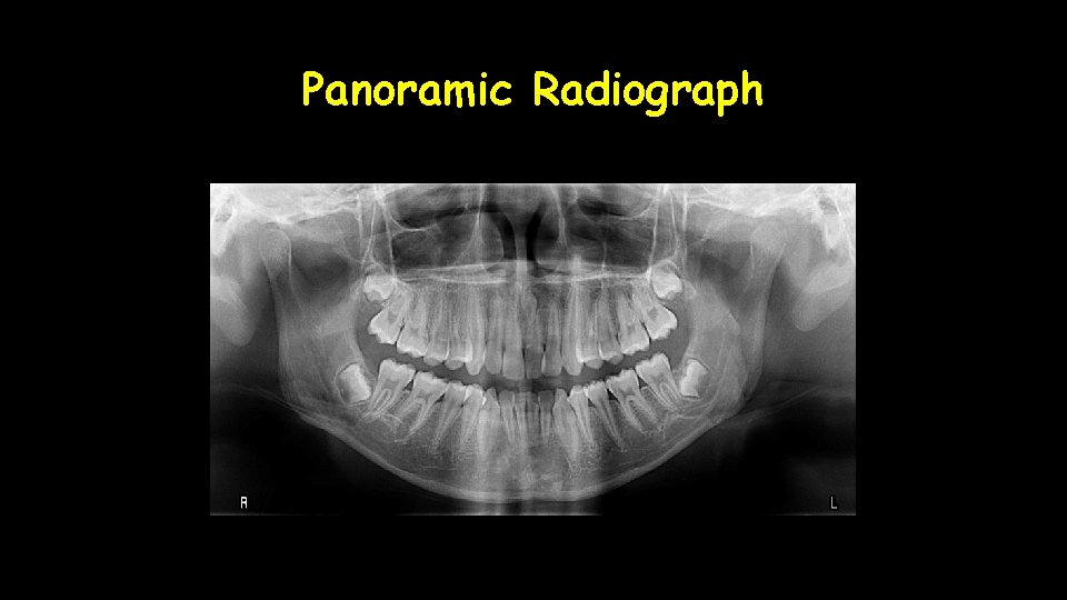 Panoramic Radiograph 