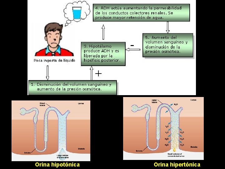 Orina hipotónica Orina hipertónica 
