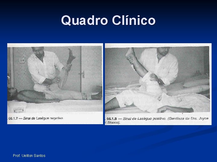 Quadro Clínico Prof. Ueliton Santos 