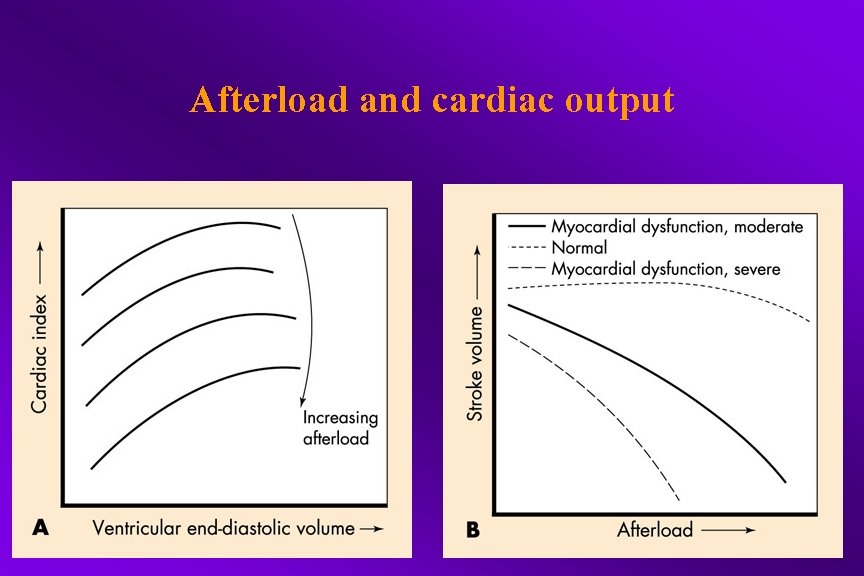 Afterload and cardiac output 