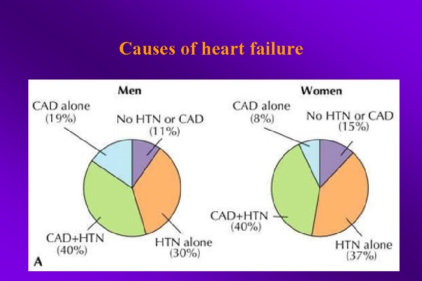 Causes of heart failure 