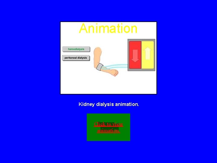 Animation Kidney dialysis animation. Click to view animation. 