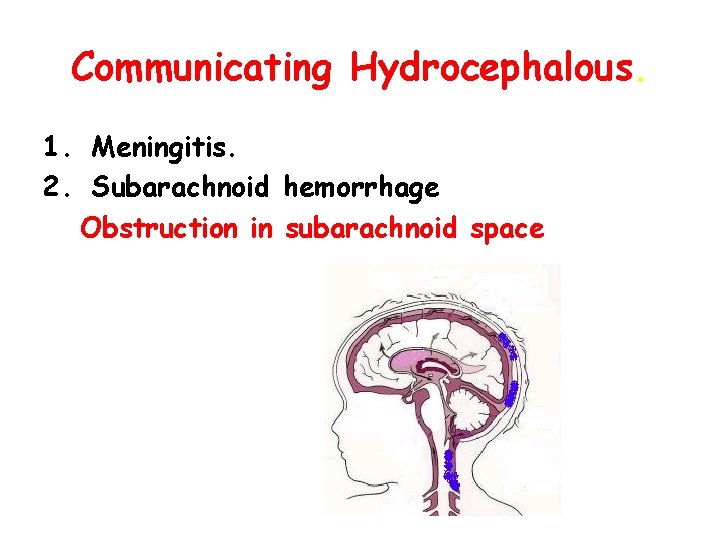 Communicating Hydrocephalous. 1. Meningitis. 2. Subarachnoid hemorrhage Obstruction in subarachnoid space 