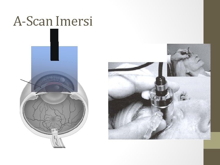 A-Scan Imersi A-Scan Imersi