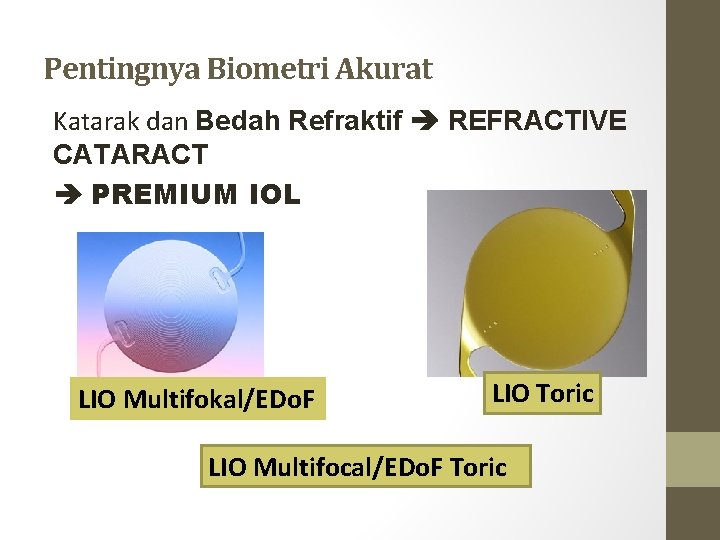 Pentingnya Biometri Akurat Katarak dan Bedah Refraktif REFRACTIVE CATARACT PREMIUM IOL LIO Multifokal/EDo. F Pentingnya Biometri Akurat Katarak dan Bedah Refraktif REFRACTIVE CATARACT PREMIUM IOL LIO Multifokal/EDo. F