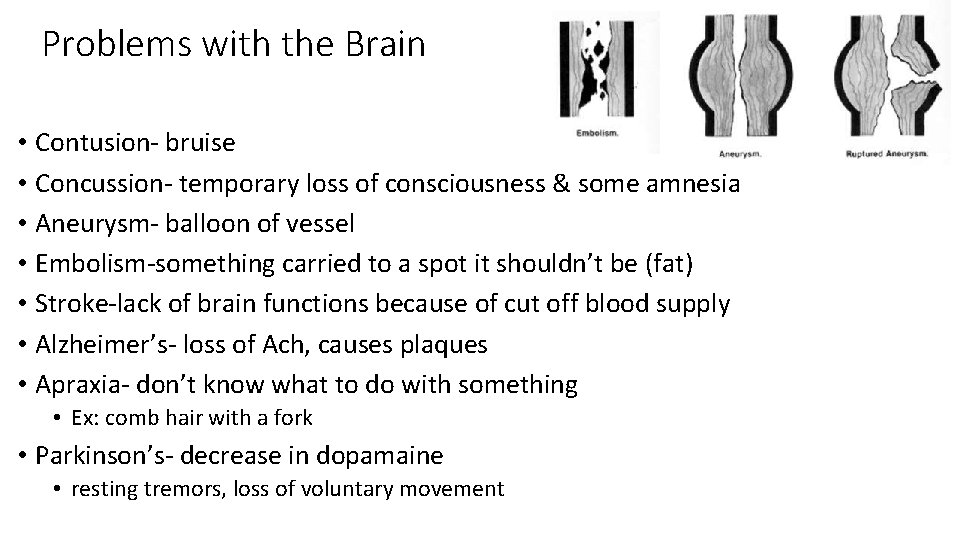 Problems with the Brain • Contusion- bruise • Concussion- temporary loss of consciousness &