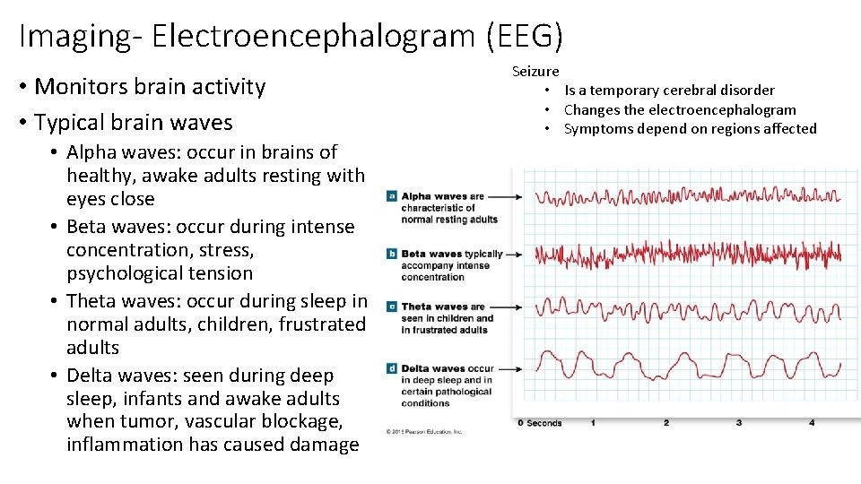 Imaging- Electroencephalogram (EEG) • Monitors brain activity • Typical brain waves • Alpha waves: