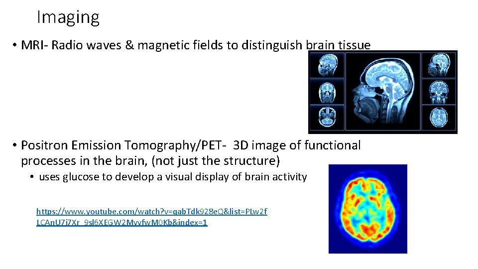 Imaging • MRI- Radio waves & magnetic fields to distinguish brain tissue • Positron