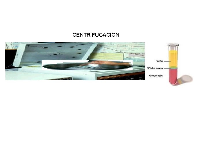 CENTRIFUGACION 