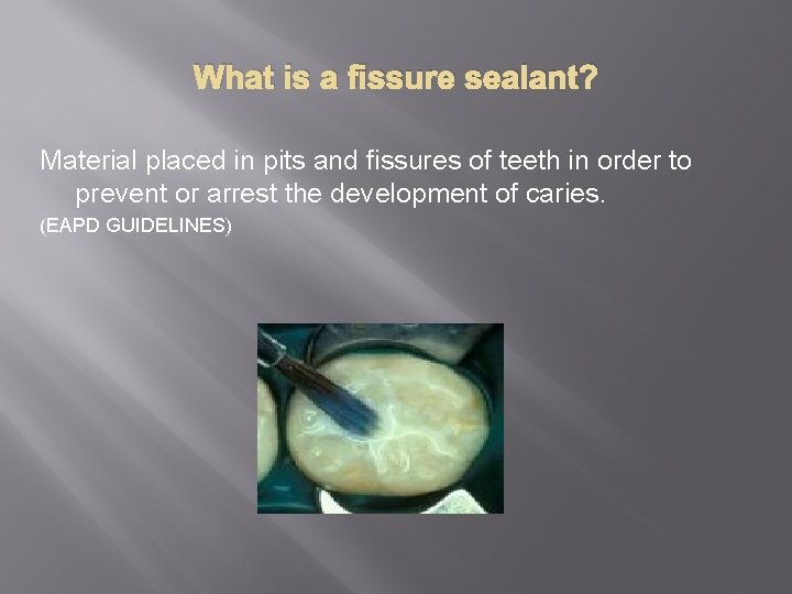 What is a fissure sealant? Material placed in pits and fissures of teeth in