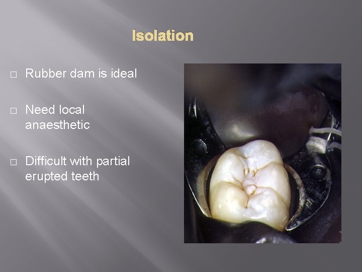 Isolation � Rubber dam is ideal � Need local anaesthetic � Difficult with partial