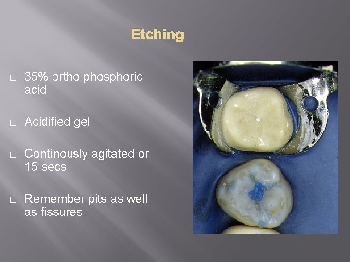 Etching � 35% ortho phosphoric acid � Acidified gel � Continously agitated or 15
