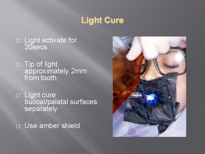 Light Cure � Light activate for 20 secs � Tip of light approximately 2