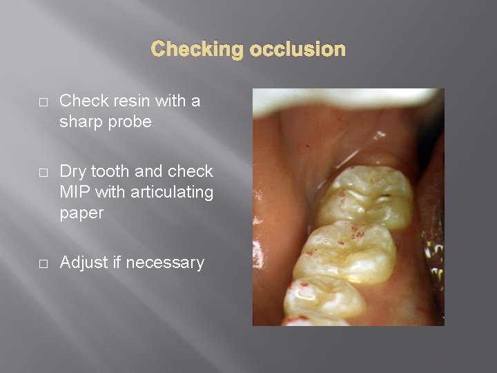 Checking occlusion � Check resin with a sharp probe � Dry tooth and check