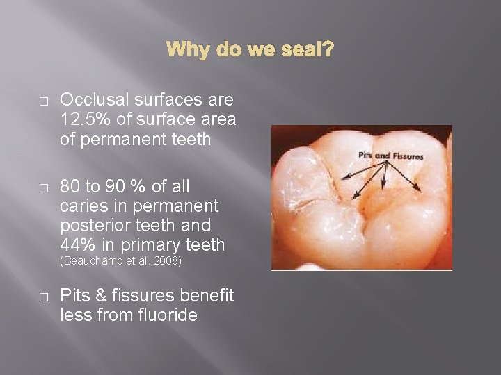 Why do we seal? � Occlusal surfaces are 12. 5% of surface area of