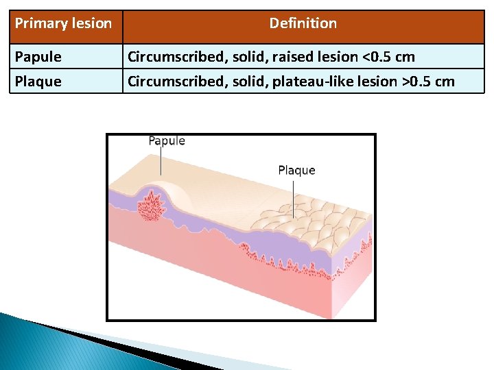 Primary lesion Papule Plaque Definition Circumscribed, solid, raised lesion <0. 5 cm Circumscribed, solid,