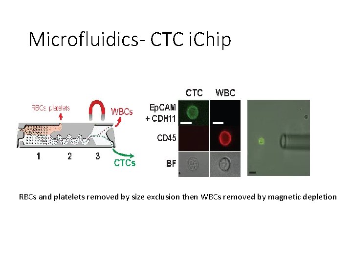 Microfluidics- CTC i. Chip RBCs and platelets removed by size exclusion then WBCs removed