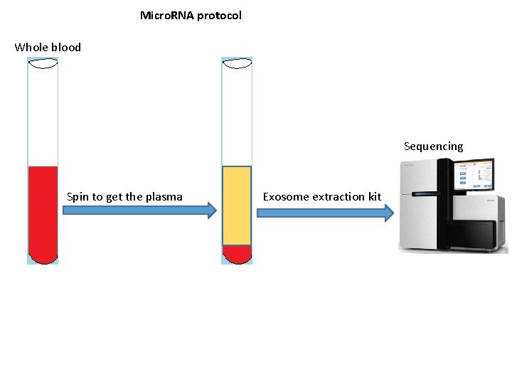 Micro. RNA protocol Whole blood Sequencing Spin to get the plasma Exosome extraction kit