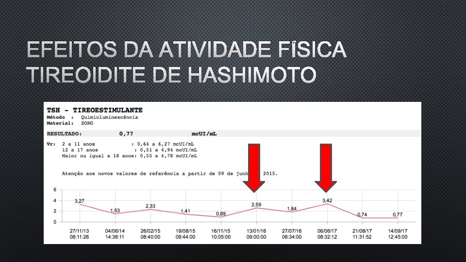 EFEITOS DA ATIVIDADE FÍSICA TIREOIDITE DE HASHIMOTO 