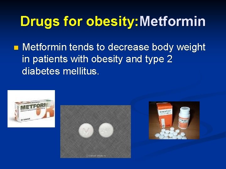 Drugs for obesity: Metformin n Metformin tends to decrease body weight in patients with