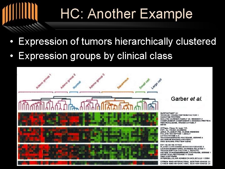 HC: Another Example • Expression of tumors hierarchically clustered • Expression groups by clinical