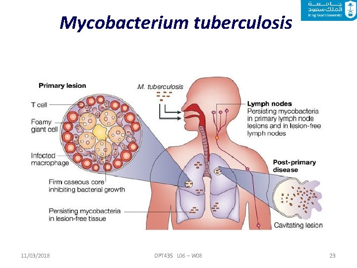 Mycobacterium tuberculosis 11/03/2018 OPT 435 L 06 – W 08 23 