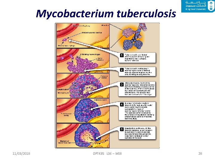 Mycobacterium tuberculosis 11/03/2018 OPT 435 L 06 – W 08 28 