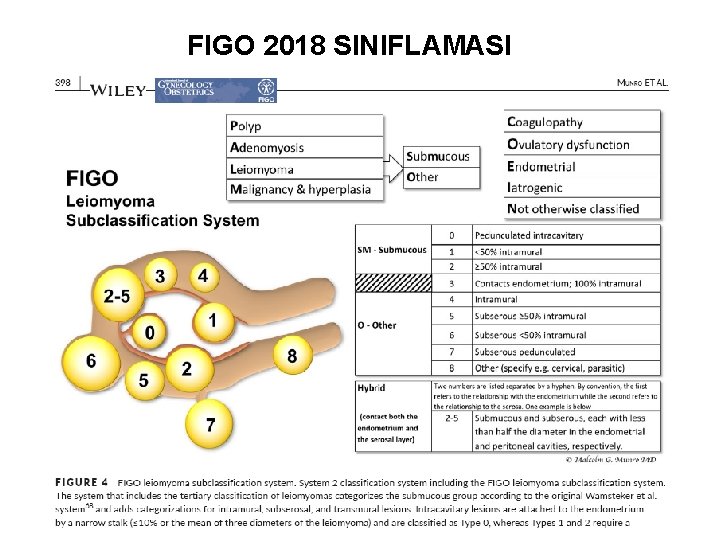 FIGO 2018 SINIFLAMASI 