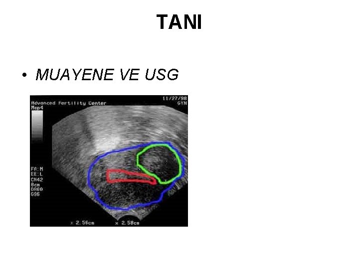 TANI • MUAYENE VE USG 