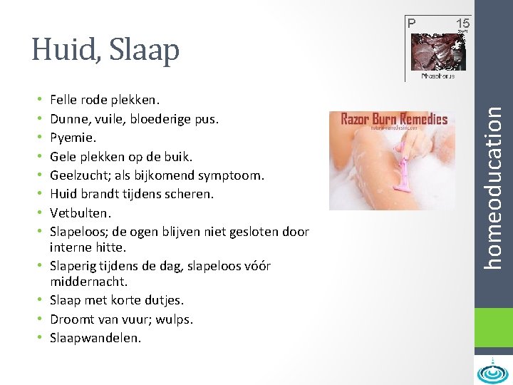  • • • Felle rode plekken. Dunne, vuile, bloederige pus. Pyemie. Gele plekken