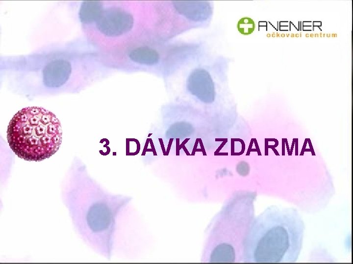 3. DÁVKA ZDARMA 