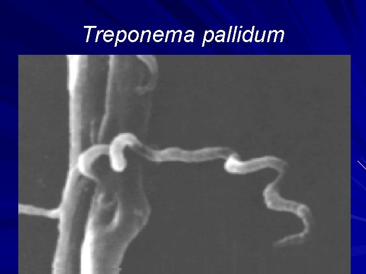 Treponema pallidum 