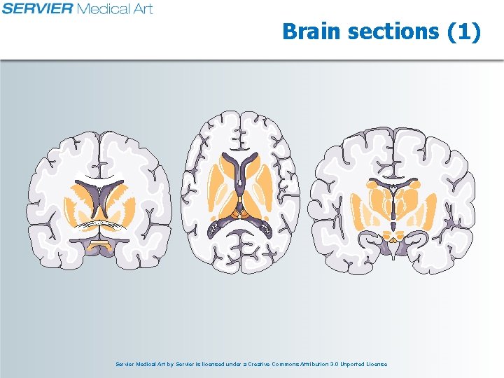 Brain sections (1) Servier Medical Art by Servier is licensed under a Creative Commons