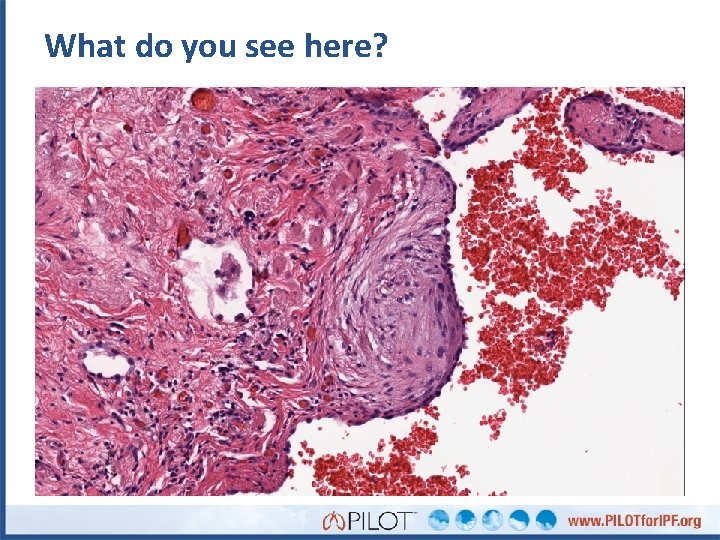 What do you see here? 