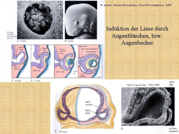 W. Larsen, Human Embryology, Churchill Livingstone, 2009 Induktion der Linse durch Augenbläschen, bzw. Augenbecher