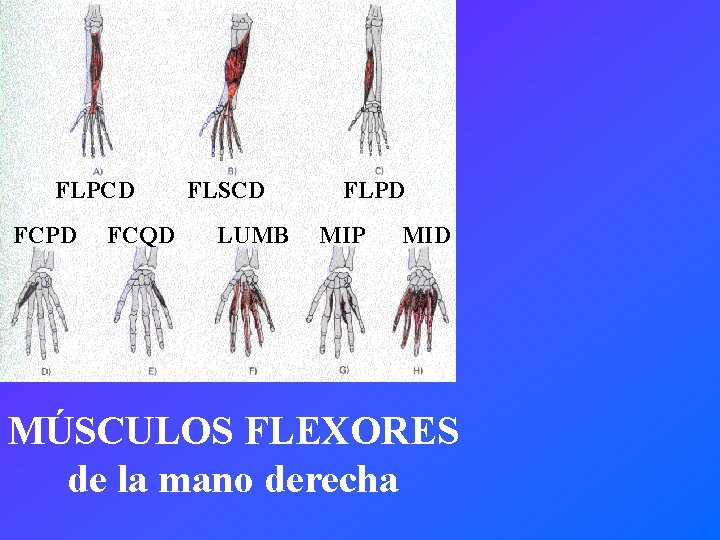 FLPCD FCPD FCQD FLSCD LUMB FLPD MIP MID MÚSCULOS FLEXORES de la mano derecha