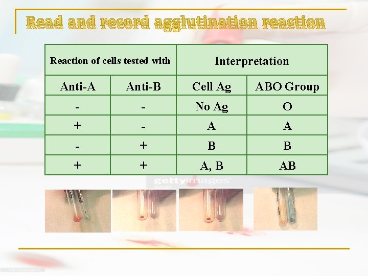 Read and record agglutination reaction Reaction of cells tested with Interpretation Anti-A Anti-B Cell