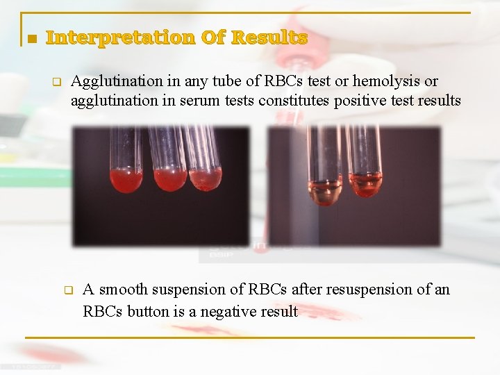 n Interpretation Of Results q Agglutination in any tube of RBCs test or hemolysis