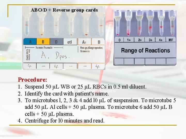 ABO/D + Reverse group cards Procedure: 1. Suspend 50 µL WB or 25 µL