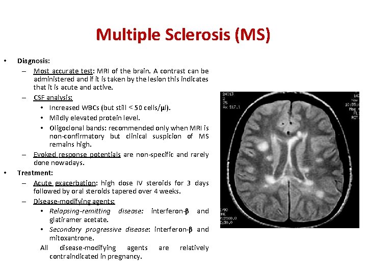 Multiple Sclerosis (MS) • • Diagnosis: – Most accurate test: MRI of the brain.